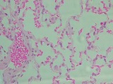 simple squamous epi_with RBCs in capillary_lung alveoli_400x, p000122