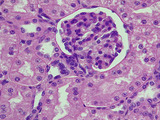 Kidney glomerulus with juxtaglomerular apparatus_630x, p000134
