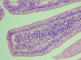 simple columnar epi with goblet cells_intestine_400x, p000138