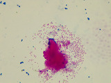 Micrograph Escherichia coli and Mycobacterium smegmatis acid fast 1000X p000173