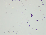 Micrograph Lactococcus lactis gram stain 1000X p000176