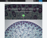 Angiosperm Morphology: Monocotyledonous Stems