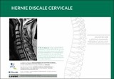 Hernie discale cervicale