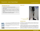 OER-UCLouvain: Amputations : types d'appareillages