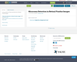 Glaucoma Detection in Retinal Fundus Images