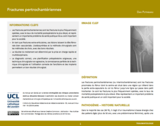 OER-UCLouvain: Fractures pertrochantériennes