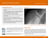 OER-UCLouvain: Fractures de l’humérus proximal
