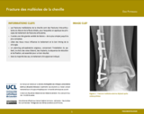 OER-UCLouvain: Fracture des malléoles de la cheville
