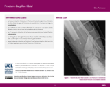 OER-UCLouvain: Fracture du pilon tibial