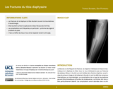 OER-UCLouvain: Les fractures du tibia diaphysaire