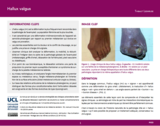 OER-UCLouvain: Hallux valgus