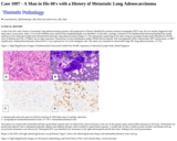 Pathology Case Study: A Man in His 60's with  a History of Metastatic Lung Adenocarcinoma