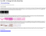 Pathology Case Study: A Teenage Girl with  a Brain Mass