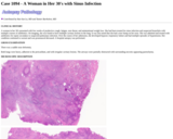 Pathology Case Study: A Woman in Her 30's with Sinus Infection