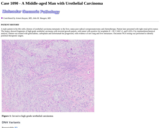 Pathology Case Study: A Male in His 50s with a Renal Mass