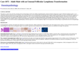 Pathology Case Study: Adult Male with an Unusual Follicular Lymphoma Transformation