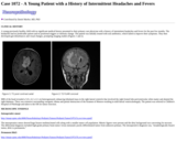 Pathology Case Study: A Young Patient with  a History of Intermittent Headaches and Fevers