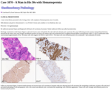 Pathology Case Study: A Man in His 30s with Hematospermia