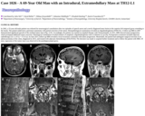 Pathology Case Study: A 69-Year Old Man with an Intradural, Extramedullary Mass at TH12-L1