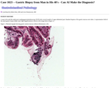 Pathology Case Study: Gastric Biopsy from Man in His 40's - Can AI Make the Diagnosis?