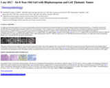 Pathology Case Study: An 8-Year-Old Girl with Blepharospasm and Left Thalamic Tumor