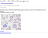 Pathology Case Study: A Male with Recent Traumatic Splenectomy