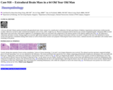 Pathology Case Study: Extradural Brain Mass in a 64 Old Year Old Man