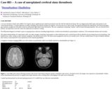 Pathology Case Study: A case of unexplained cerebral sinus thrombosis