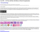 Pathology Case Study: A 59 Year-old Man with History of Renal Transplantation