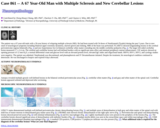 Pathology Case Study: A 67 Year-Old Man with Multiple Sclerosis and New Cerebellar Lesions