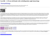 Pathology Case Study: A 59 year old female with  cerebellopontine angle hemorrhage