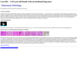 Pathology Case Study: A 65-year-old female with an incidental lung mass