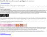Pathology Case Study: A 48 year old woman with right leg and arm numbness