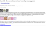 Pathology Case Study: Two cases of intraventricular hemorrhage in young patients