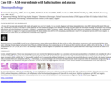 Pathology Case Study: A 58-year-old male with  hallucinations and atasxia