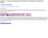 Pathology Case Study: A Neonate with Spontaneous Pneumothorax and Progressive Respiratory Failure