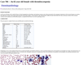 Pathology Case Study: An 82 year old female with thrombocytopenia