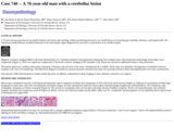 Pathology Case Study: A 76-year-old man with a cerebellar lesion