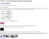 Pathology Case Study: An 18 year old male with microscopic hematuria