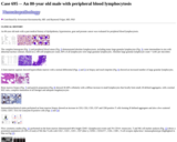 Pathology Case Study: An 80-year old male with  peripheral blood lymphocytosis