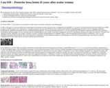 Pathology Case Study: Posterior fossa lesion 45 years after ocular trauma