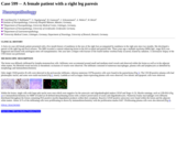 Pathology Case Study: A female patient with a right leg paresis