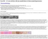 Pathology Case Study: A 5-year-old boy with one month history of intracranial hypertension