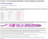 Pathology Case Study: A 57 year old male with hepatitis C infection, lymphoma and renal disease