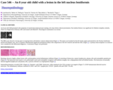 Pathology Case Study: An 8 year old child with  a lesion in the left nucleus lentiformis