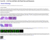 Pathology Case Study: A 62 Year-old Male with Flank Pain and Hematuria