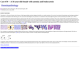 Pathology Case Study: A 56-year-old female with anemia and leukocytosis