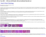 Pathology Case Study: A 68 year-old female with  an incidental thyroid cyst