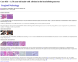 Pathology Case Study: A 79-year-old male with a lesion in the head of the pancreas