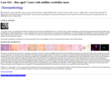 Pathology Case Study: A boy aged 7 years with  primitive neuroectodermal tumor